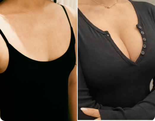 배파고리 before&after 이미지