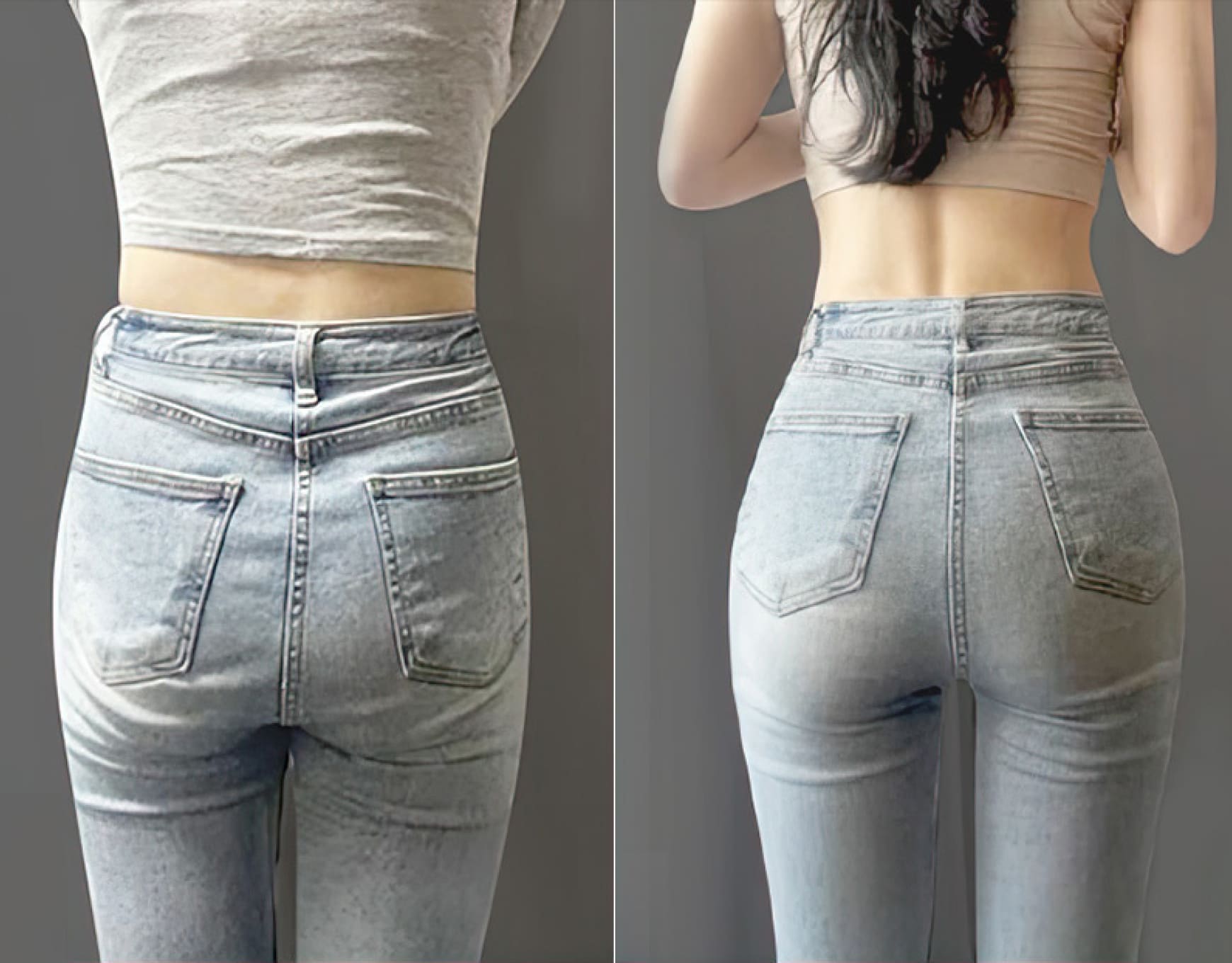 허파고리 before&after 이미지